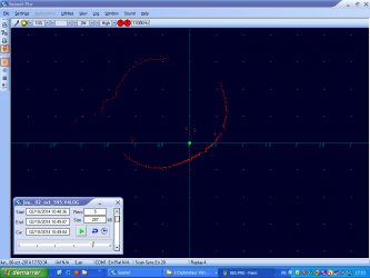 Auscultation sonar